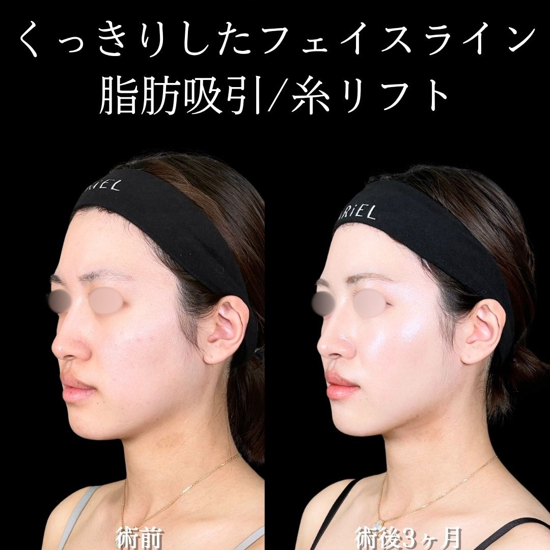 No.16487の症例写真